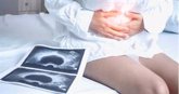 Foto: Experta asegura que el 30 por ciento de las endometriosis se detectan durante el tratamiento de reproducción