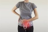 Foto: Endometriosis, expertos abordan su diagnostico y complejidad