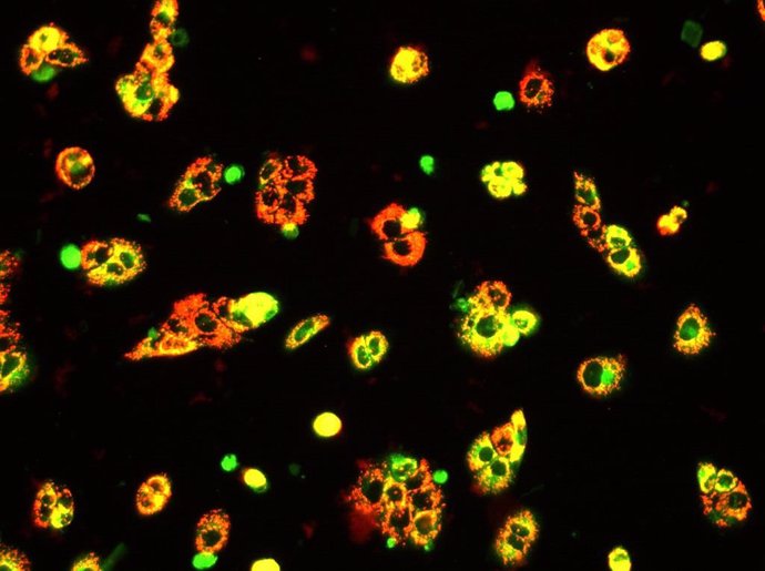 Señalización del daño mitocondrial provocado por la terapia combinada en células tumorales hepáticas.