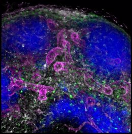 Archivo - Los anticuerpos administrados por vía subcutánea se han transportado al ganglio linfático y se han unido a sus dianas específicas en los vasos sanguíneos (magenta), linfocitos T (verde), linfocitos B (azul) y células presentadoras de antígeno 