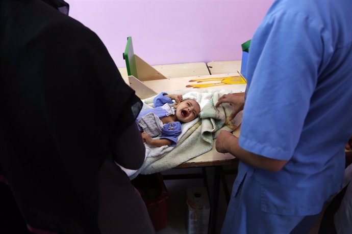 Archivo - Sanitarios pesan a un niño desnutrido en un hospital en Saná, Yemen.