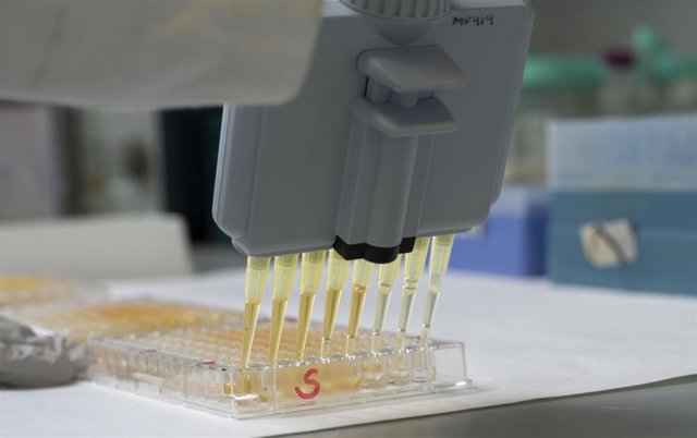 Archivo - Los test serológicos para la covid-19 del CSIC