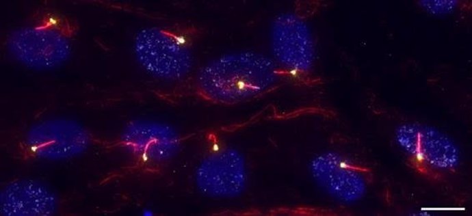 Investigadores del CSIC estudiarán la proteína NEK8, relacionada con una de las enfermedades congénitas más raras