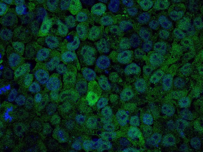 Archivo - Imagen de células madre embrionarias con bajos niveles de PI3K.