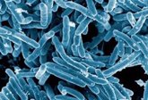 Foto: Dos tipos de células ayudan a 2.000 millones de personas a mantener a raya la tuberculosis
