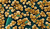 Foto: Descubren cómo el 'Staphylococcus aureus' adquiere mutaciones que le permiten colonizar parches de eccema
