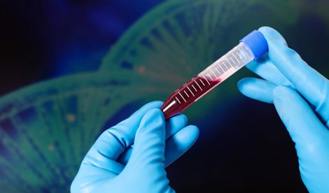 Investigación