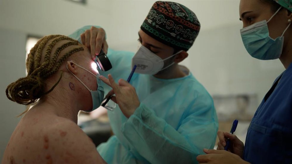 Dermatólogos internacionales ayudan a tratar el cáncer de piel de albinos en Moz