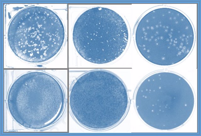 Efecto inhibidor de la infección por SARS-CoV-2 en células humanas de colon (izquierda) y pulmón (centro) y por TGEV en células de testículo porcinas (derecha) de las moléculas sintéticas de ARN (panel inferior).
