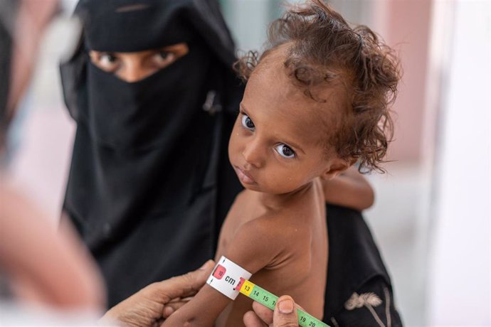 Archivo - Una niña con desnutrición en Yemen.