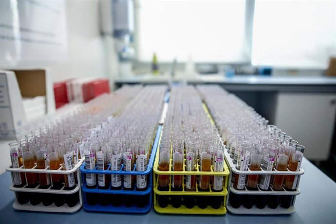 Archivo - Tubos de sangre en un laboratorio.