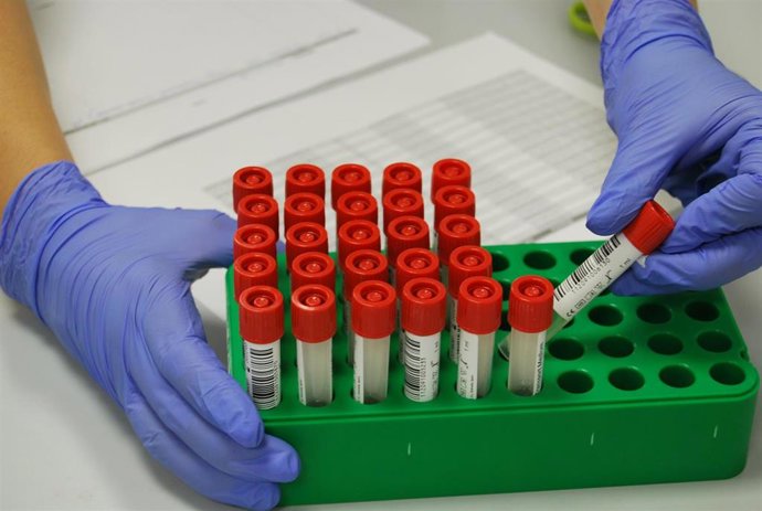 Archivo - Pruebas para el covid