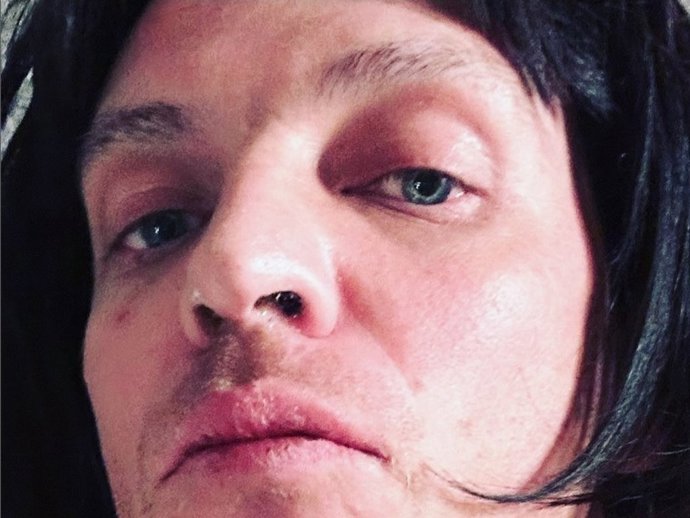 CAMILO BLANES CUELGA MÁS IMÁGENES PREOCUPANTES EN SU RED SOCIAL