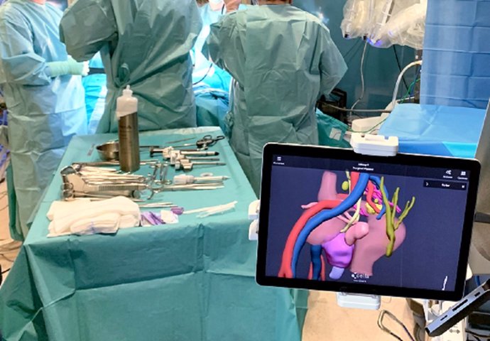 La tecnología 3D mejora los resultados de la cirugía en la enfermedad de Crohn.