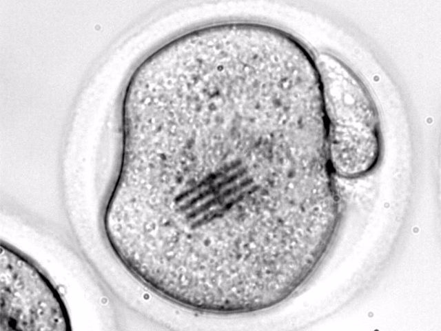Archivo - Embrión con un chip en su citoplasma
