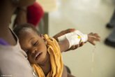 Foto: UNICEF denuncia la situación actual del cólera y pide de manera "urgente" 444 millones de euros para prevenirlo