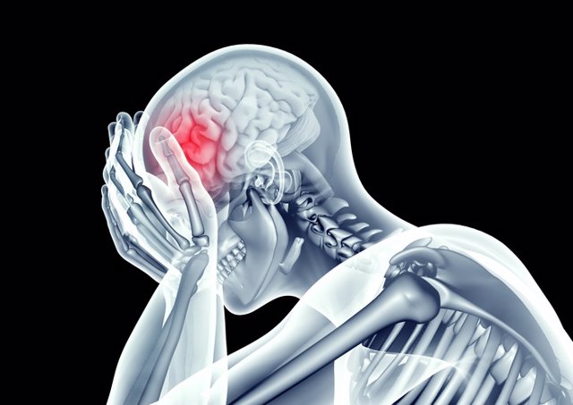 Archivo - Imagen de rayos x cabeza humana con dolor de cabeza