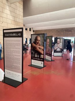 La exposición 'Calvas&Bellas' en el Hospital Reina Sofía de Córdoba.