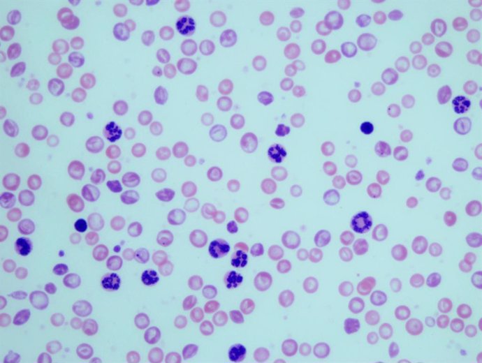 Archivo - Granulocitos en muestras sanguíneas de ratones con leucemia mielogénica crónica.