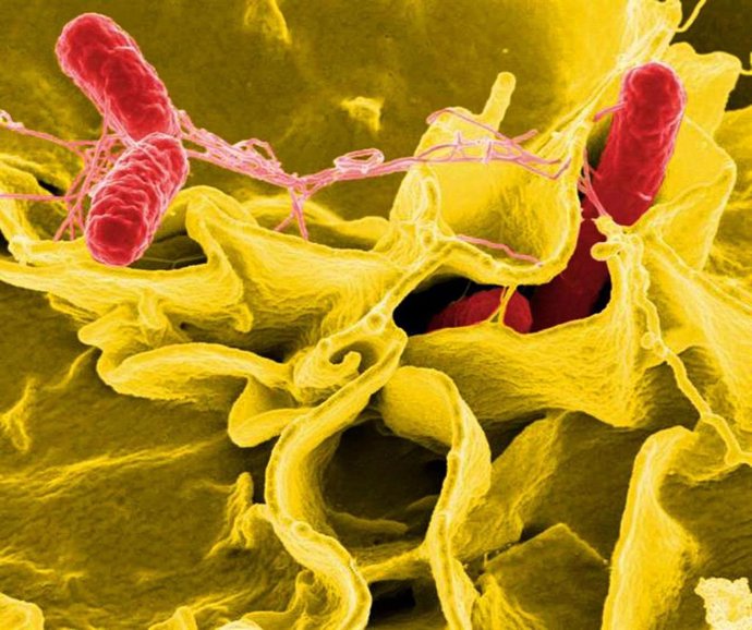 Archivo - Bacteria salmonella, salmonela