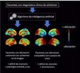 Foto: Un nuevo estudio ayuda a un mejor diagnósticos del Alzheimer con el uso de técnicas de imagen médica