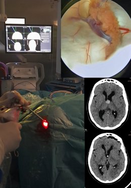 Cirugía endoscópica.