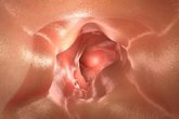 Foto: ¿Influye el sexo en el cáncer colorrectal?