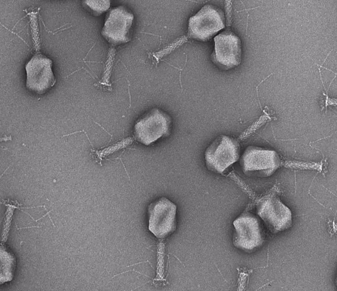 Archivo - Micrografía electrónica de fagos.