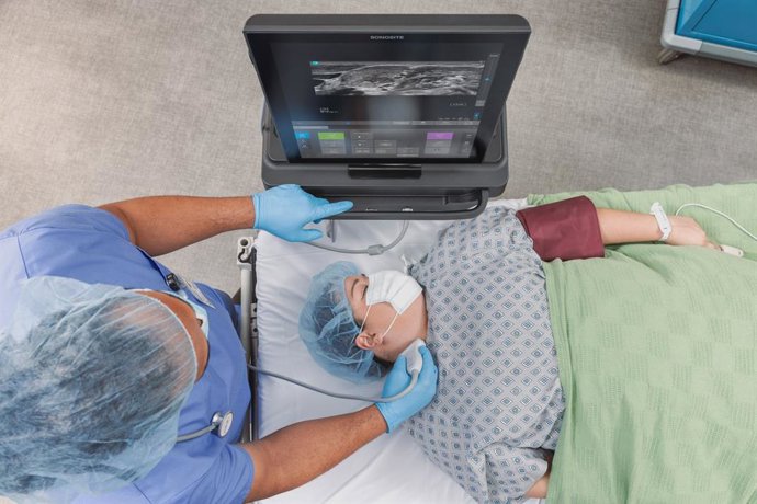 Nervio ecógrafo Sonosite ST.