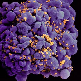 Archivo - Micrografía electrónica de barrido de una célula T H9 infectada por el VIH.