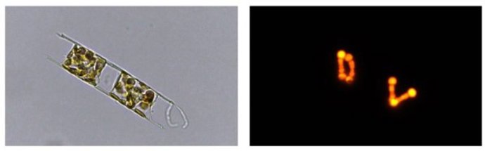 Asociación de la diatomea 'Hemiaulus hauckii' y la cianobacteria 'Richelia intracellularis' del Mediterráneo oriental. La micrografía de la izquierda muestra a la diatomea, mientras que la de la derecha identifica a la cianobacteria en su interior