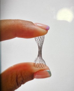 El Hospital de Elche implanta un nuevo dispositivo para tratar la angina de pecho pionero en la provincia