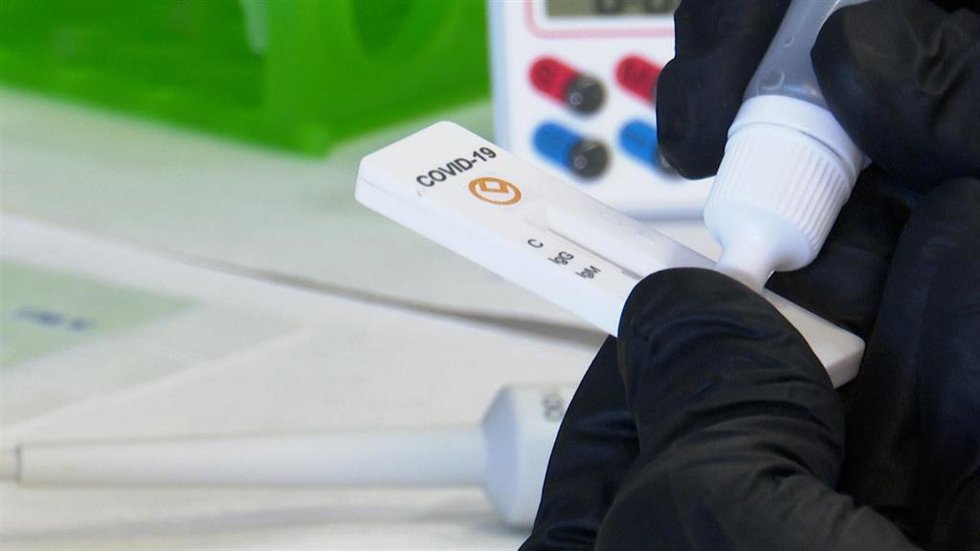 Archivo - Un laboratorio valenciano desarrolla un test rápido de detección de anticuerpos con un 98% de efectividad