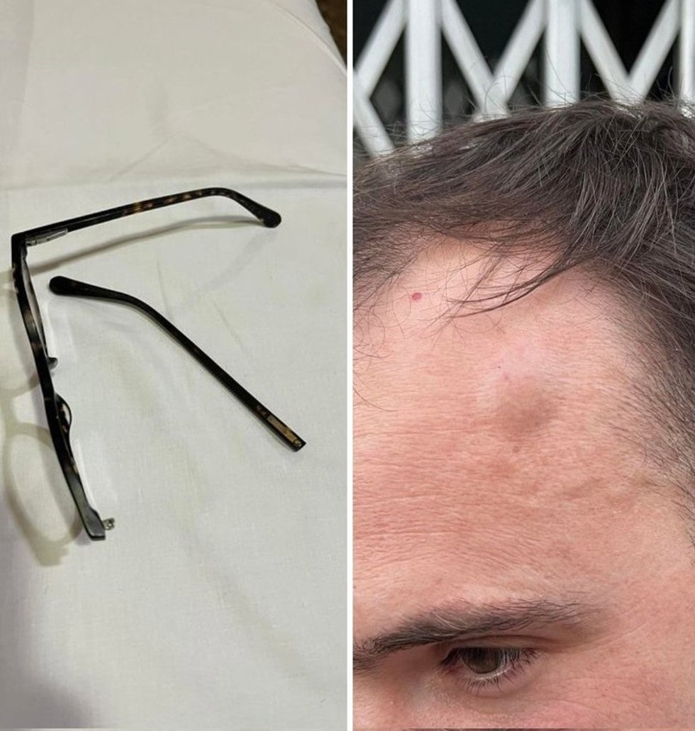 Gafas rotas y agresión sufrida por la pareja del alcalde
