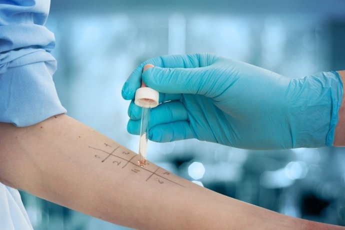 Archivo - Estudio de reacciones alérgicas