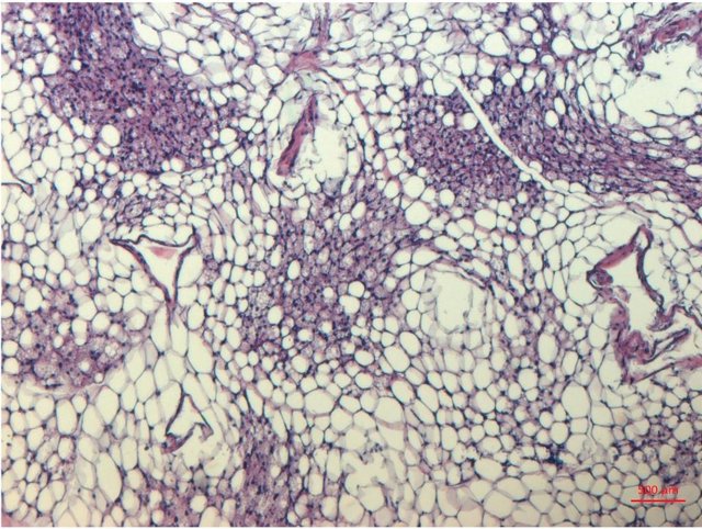 Archivo - Tejido adiposo blanco con adipocitos blanco y beige (la tinción púrpura identifica las células beige) para el control y las muestras eliminadas con TLE3.