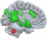Foto: Un estudio revela que el cerebelo es fuente de las crisis convulsivas generalizadas