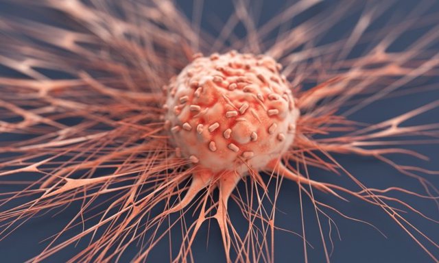 Célula de cáncer humano.