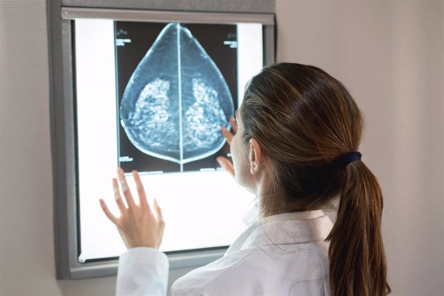 Archivo - Imagen de una mamografía.