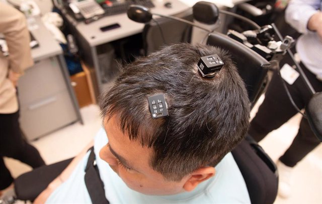 Archivo - A Keith Thomas, que vive con parálisis, le implantaron cinco microchips diminutos en su cerebro, formando una parte crítica de un "bypass neural doble" primero en su tipo que utiliza inteligencia artificial para decodificar y traducir sus pensam