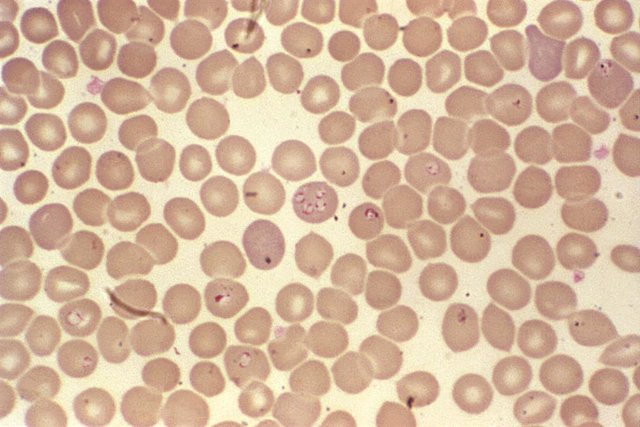 Archivo - Los hemoprotozoos parásitos del género 'Babesia sp'.