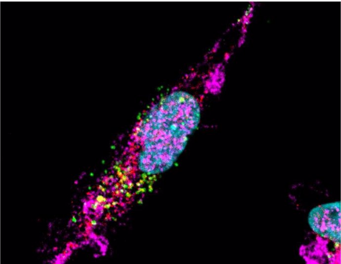 Archivo - Vesículas extracelulares de hematíes (RBCEV) captadas y clasificadas en compartimentos específicos dentro de un macrófago