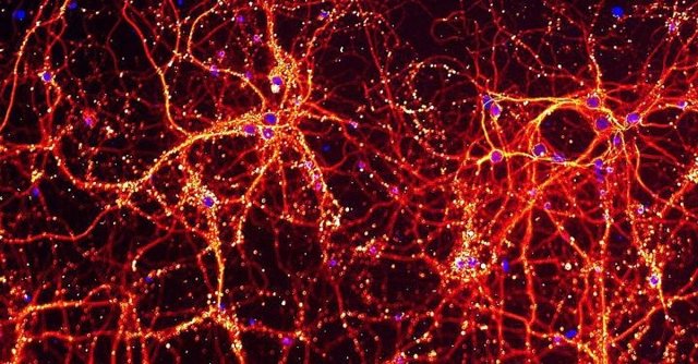 Archivo - Esta imagen muestra las neuronas y sus conexiones entre sí en rojo y amarillo, y el ADN de la célula en azul. Estas neuronas se usaron para estudiar el impacto de la infección por toxoplasma en las células.