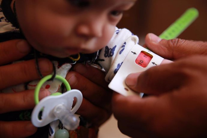 Medición del nivel de desnutrición de Nadira, de ocho meses, en una clínica móvil de Save the Children