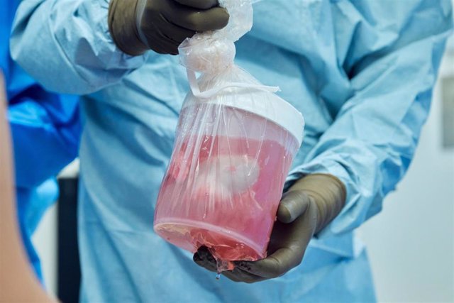 Archivo - Un equipo clínico del NYU Langone Health (Estados Unidos) ha conseguido transferir riñones de cerdos a un hombre en muerte cerebral.