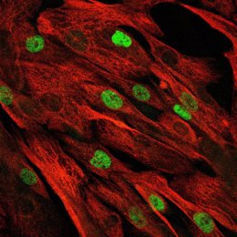Archivo - Esta imagen de microscopio confocal muestra las células madre musculares primarias del paciente, que han seguido proliferando tras la reparación de la mutación mediante la "edición de bases".