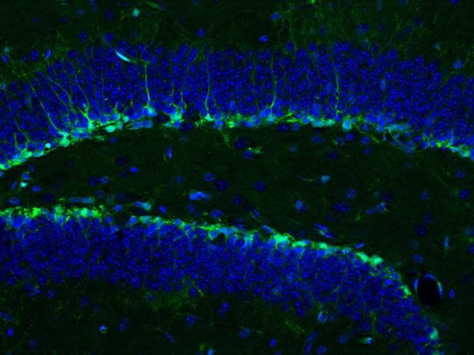 Las células madre neuronales del hipocampo de un ratón se muestran en verde (los cuerpos celulares en azul) y dan lugar a nuevas neuronas maduras.