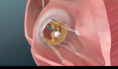 Comunicados Internacional