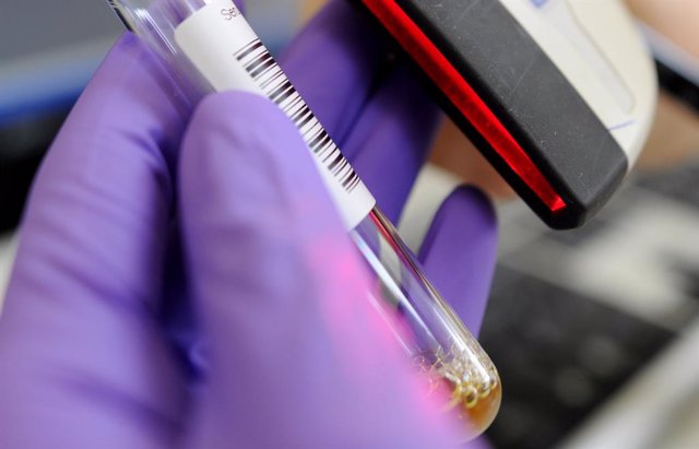 Archivo - FILED - 18 September 2012, Hamburg: A technical laboratory assistent scans the bar code of a sample in a laboratory at the diagnostic investigation unit for viruses of the Bernhard-Nocht-Institut (BNI) for tropical medicine in Hamburg. Banglades