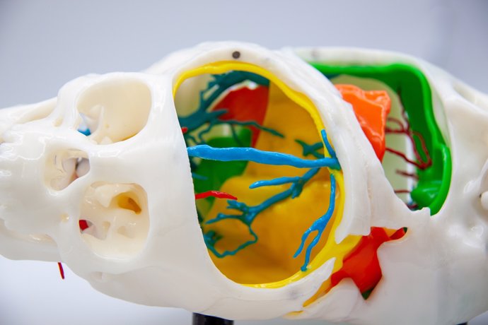 Modelo 3D cirugía cráneo siamesas